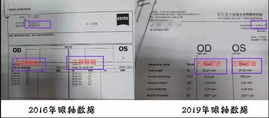 上网课惹的祸？宁波8岁孩子仅两个月近视度数增长100度